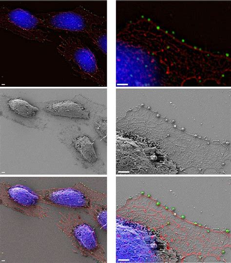 What is Pinocytosis? - Examples, Vs Phagocytosis, Vs Endocytosis