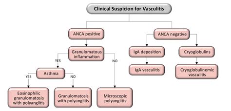 Management of Primary Small-Vessel Vasculitis