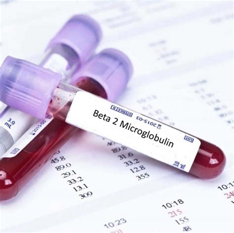 Beta 2 microglobulin, test, normal range & causes of high beta 2 ...