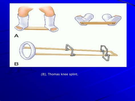 PPT - FRACTURES 0F LOWER LIMB PowerPoint Presentation, free download ...