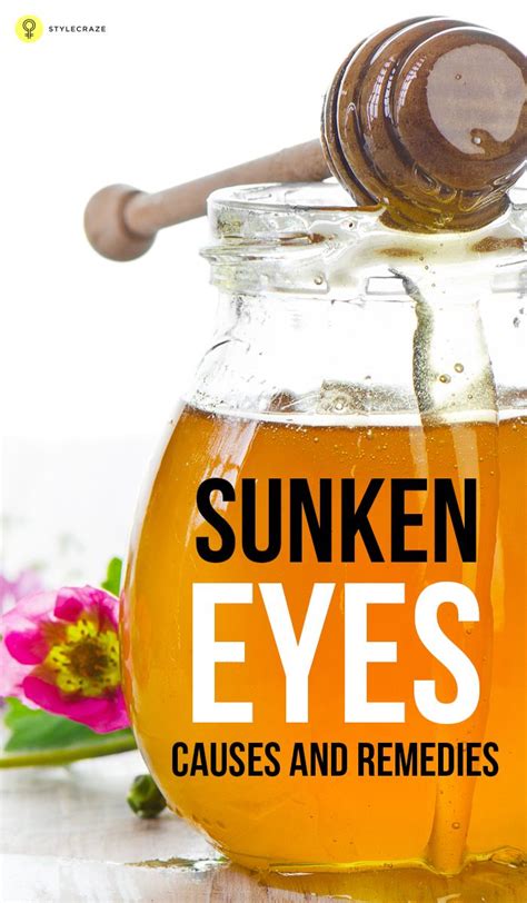 Sunken Eyes: Causes, Remedies, And Tips To Prevent | Sunken eyes, Eye care, Remedies