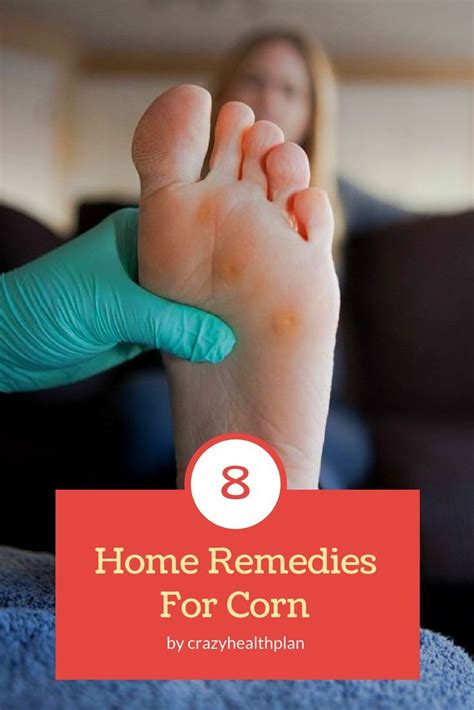 8 Best Home Remedies To Get Rid OF Corns And Calluses # ...