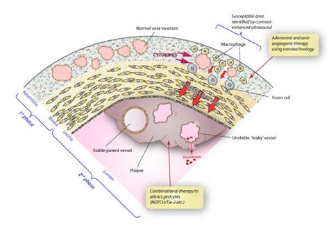 Hypothetical representation of a micro-area of a major artery showing ...