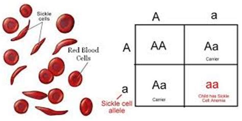 Sickle Cell Disease on emaze