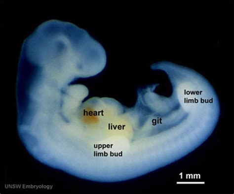 Lecture - Limb Development - Embryology