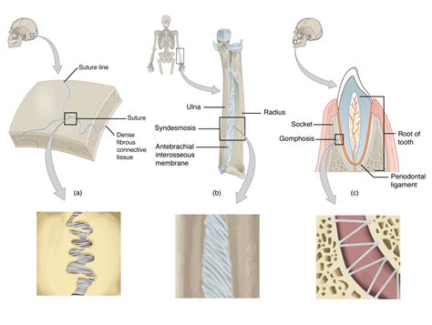 Three Types Of Fibrous Joints