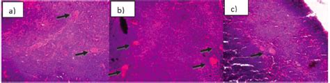 Hassall's corpuscles of the thymus (black arrow): a) AL group; b) HCL... | Download Scientific ...