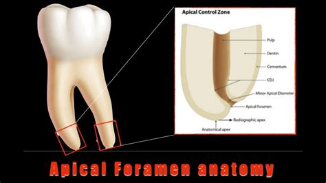 The working length - Style Italiano Endodontics