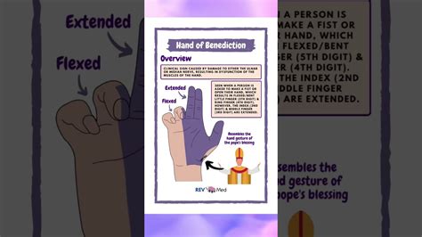 Hand of Benediction - Anatomy - YouTube