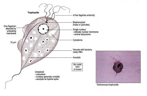 Trichomonas vaginalis trophozoites | Medical Laboratories