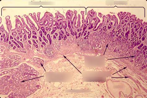 duodenum-pylorus histology Diagram | Quizlet