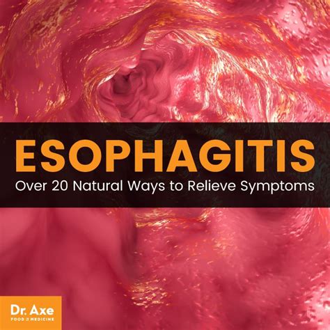 Esophagitis: Causes, Symptoms & Natural Self-Care - Dr. Axe in 2020 ...