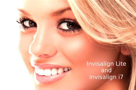 Discover the New Addition of Invisalign Family - Invisalign Lite and Invisalign i7 ~ Invisalign Tips