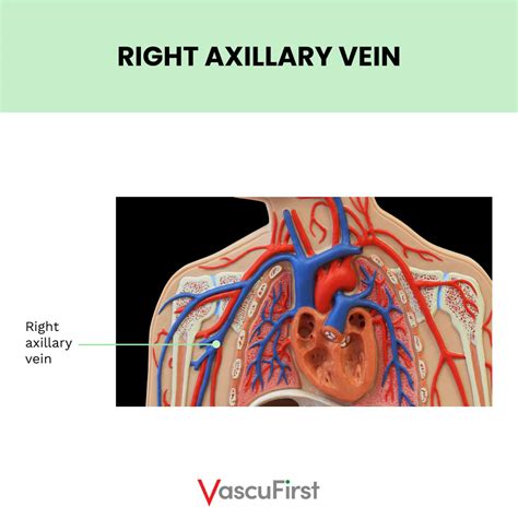 Overview of anatomy and physiology related to vascular access: veins of the chest and neck ...