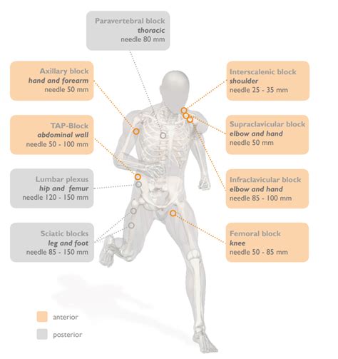 A Complete Overview of Nerve Block Techniques in Anesthesia : VYGON India