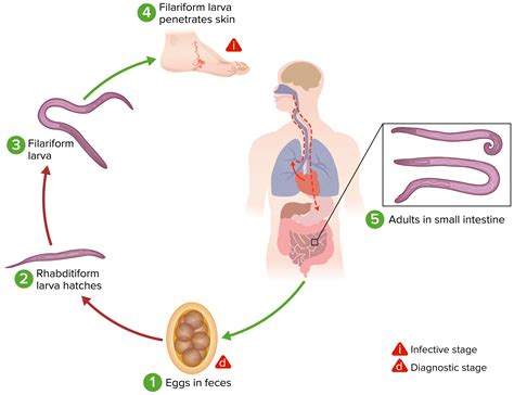 Hookworm Infections | Concise Medical Knowledge