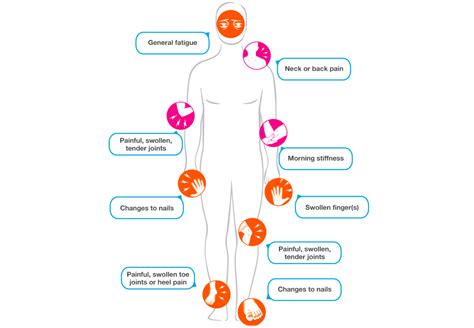 What Causes Psoriatic Arthritis