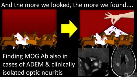 1/Are you in a FOG about MOG? MOG antibody associated disease or MOGAD ...