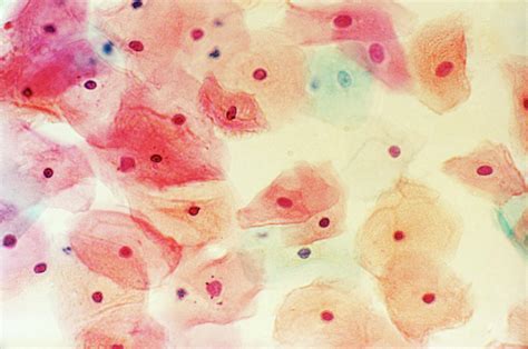 Cervical Smear Mid-cycle Photograph by Science Photo Library. - Fine ...