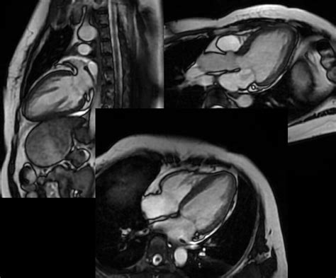 Chụp MRI tim phương pháp quan trọng như thế nào đối với sức khoẻ ...