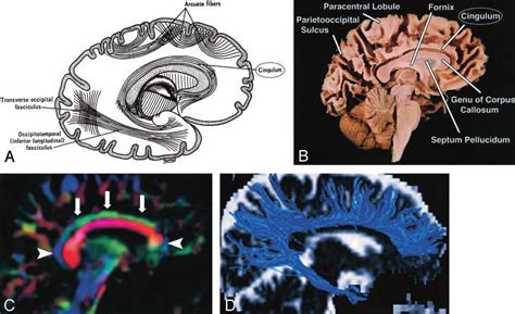 Cingulum, sagittal view. A, Illustration shows the cingulum arching ...