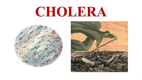 Cholera || Vibrio cholerae || Cause, Symptoms, Diagnosis, Treatment ...