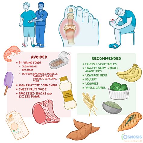 Anti-gout Diet: Foods to Eat, Foods to Avoid, and More