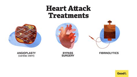 Treatment for Heart Attacks - GoodRx