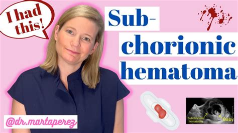 OBGYN Explains Subchorionic Hematoma | My Story First Trimester Bleeding - YouTube