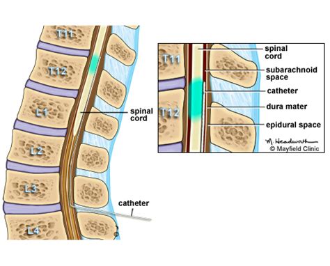 Global Pain Care | Dr. Navdeep Loomba