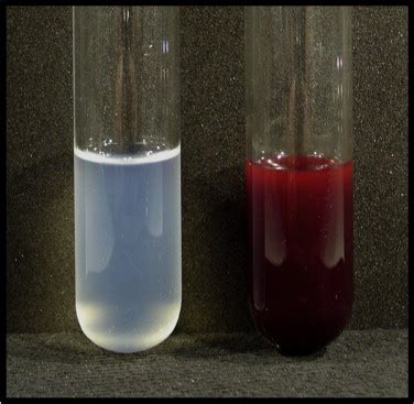 Blood from HbA and HbA-null fish. Blood samples from two Antarctic... | Download Scientific Diagram