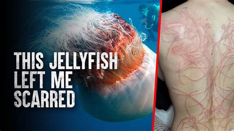 The Perils of Encounter: The World's Most Deadly Jellyfish Species