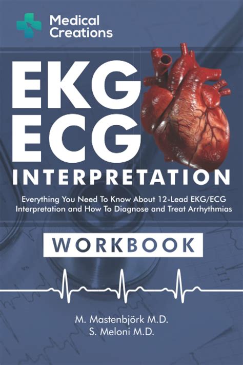 Buy EKG/ECG Interpretation: Everything you Need to Know about the 12 - Lead ECG/EKG ...