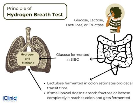 What Is the Basic Principle of the Hydrogen Breath Test?