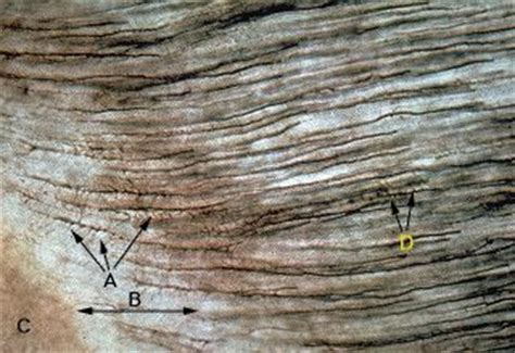 Oral Histology Digital Lab: Dentin: Branching of Odontoblast Processes (Image 6)