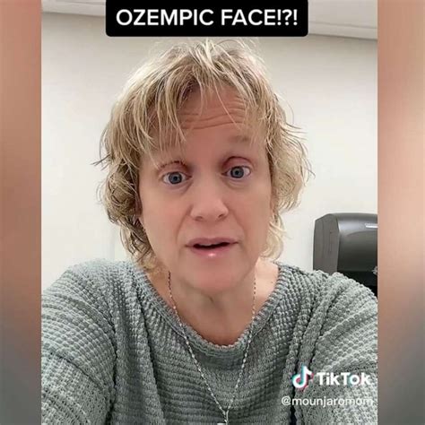 What to know about 'Ozempic face' as some users claim popular diabetes ...