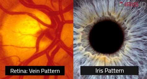 Iris recognition and retinal scans are not the same - Iris ID