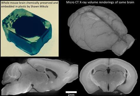 Mikula Evaluation Page – The Brain Preservation Foundation