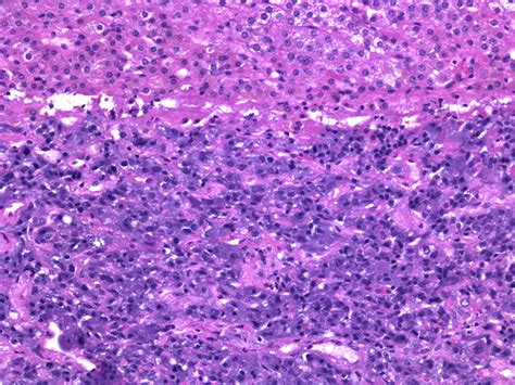 Webpathology.com: A Collection of Surgical Pathology Images