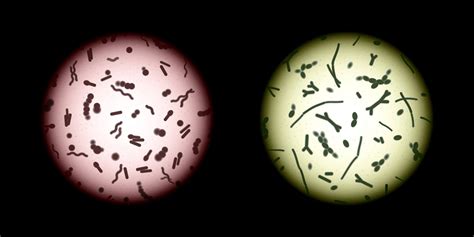 Fecal Microbiota Transplant Improved Clinical Outcomes and Decolonized Multi-Drug Resistant ...