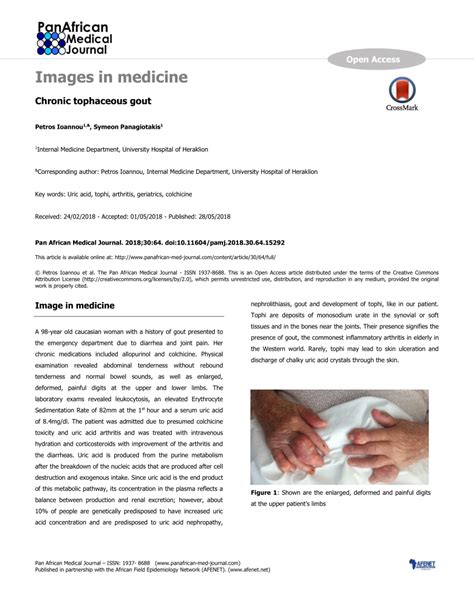 (PDF) Chronic tophaceous gout