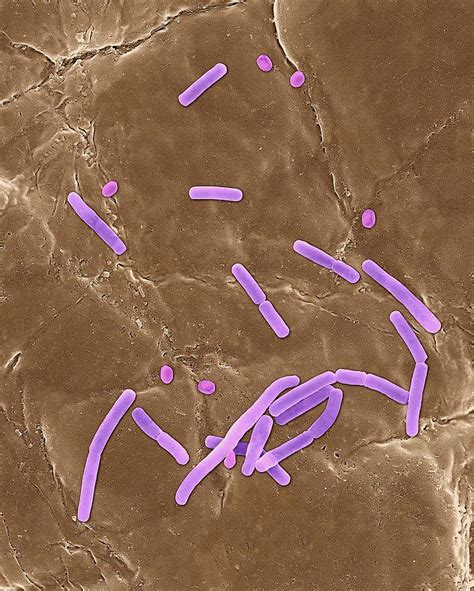 Bacillus Anthracis Photograph by Dennis Kunkel Microscopy/science Photo Library - Pixels