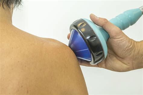 Shockwave Therapy Oakville – 10 Shockwave FAQS