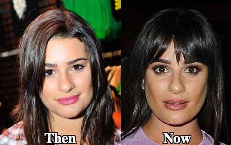 Lea Michele Nose Job Plastic Surgery Before and After Photos - Latest ...