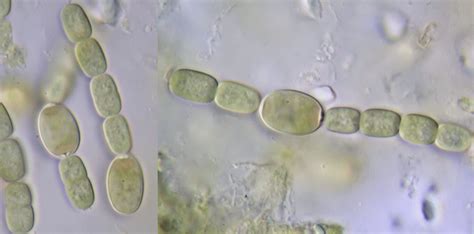 Azolla Microscope