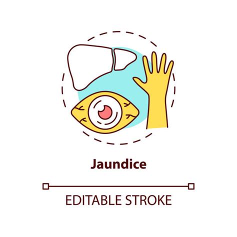 Drawing Of The Jaundice Illustrations, Royalty-Free Vector Graphics ...