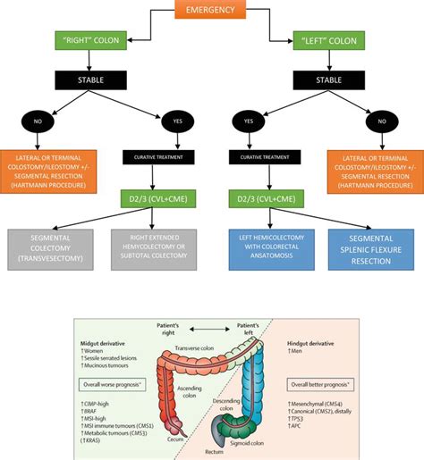 Emergency Treatment of Transverse Colon Cancer | IntechOpen