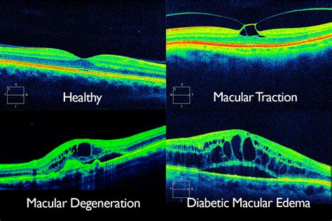 Comprehensive Eye Exam | Eyes and Vision Optometrists | Book Online Now