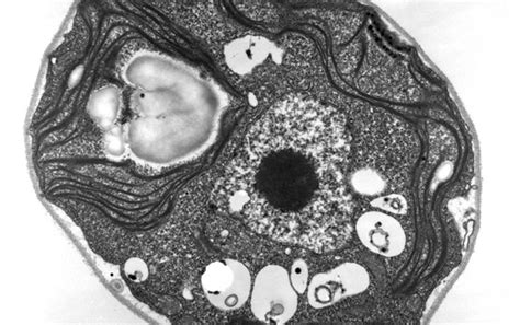 How Cells Know When It’s Time to Eat Themselves