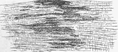 3. Fatty Degeneration Of The Muscular Substance